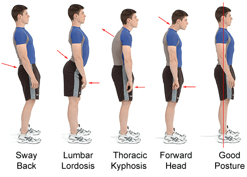 Posture Challenge